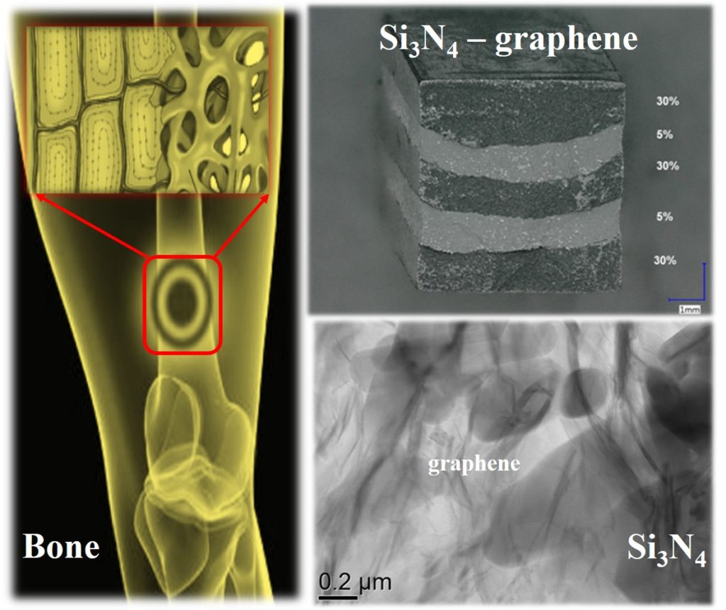 The solid-porous structure of bone and structure of the developed layered functional gradient Si3N4-graphene ceramic composite.